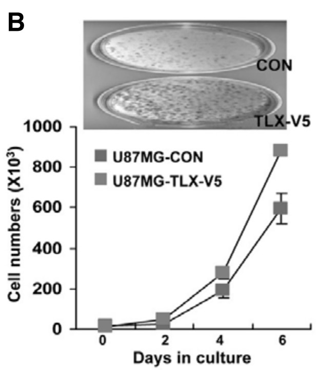 Increased cell proliferation in TLX- overexpressing U87MG glioma cells.jpg